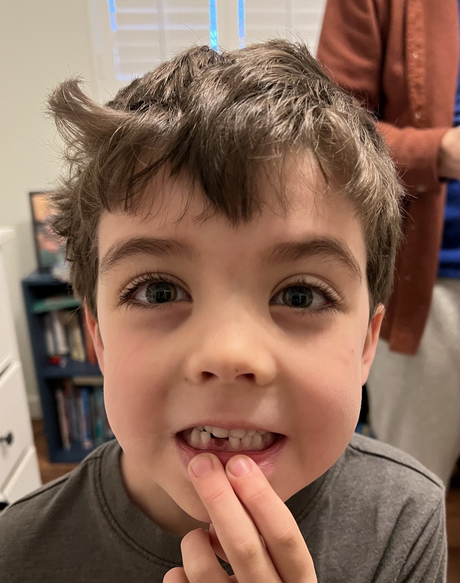 Ben lost his first tooth!